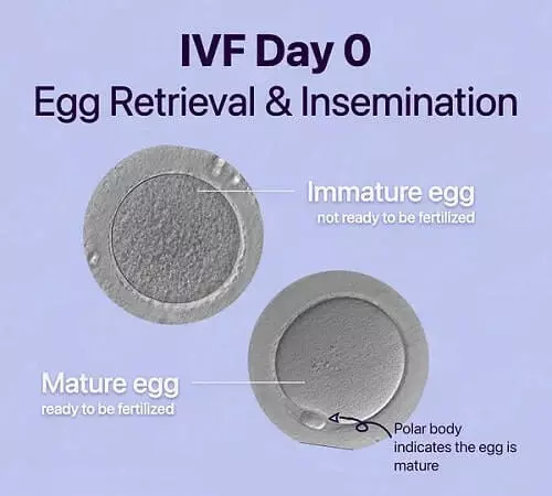 Egg Retrieval and Insemination Day-0