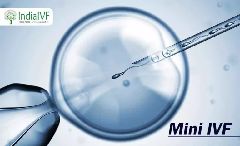 Mini-IVF