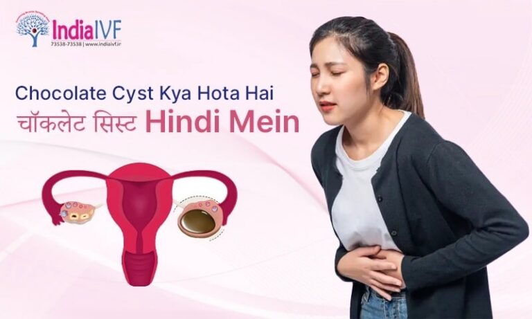 Chocolate Cyst Kya Hota hai