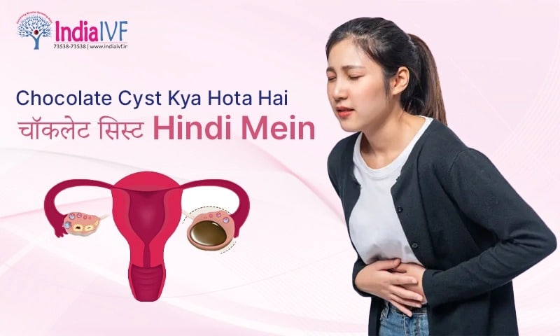 Chocolate Cyst Kya Hota hai