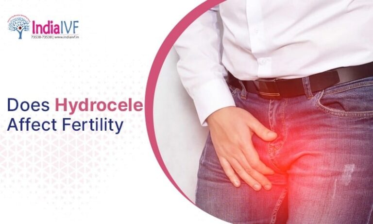 Done Hydrocele Affect Fertility