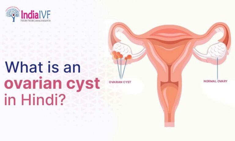 What is an ovarian Cyst in Hindi