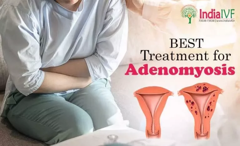 Adenomyosis