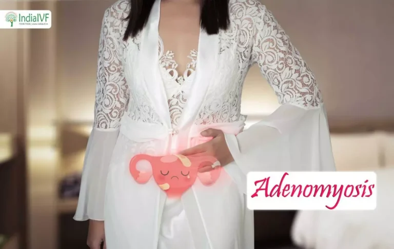 Adenomyosis
