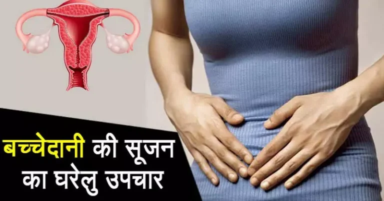 Bulky-Uterus
