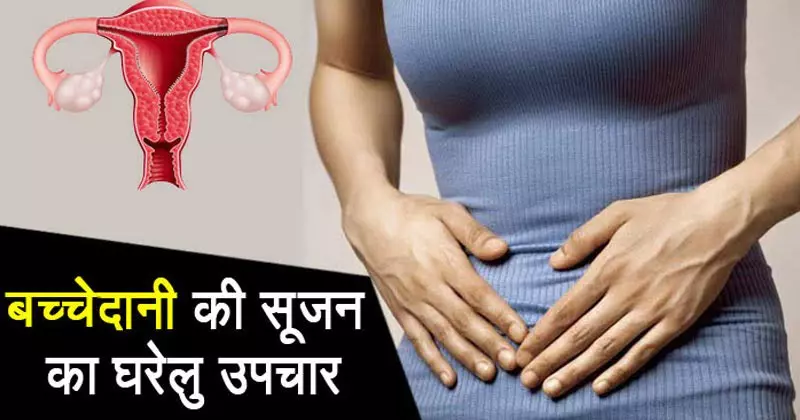 Bulky-Uterus
