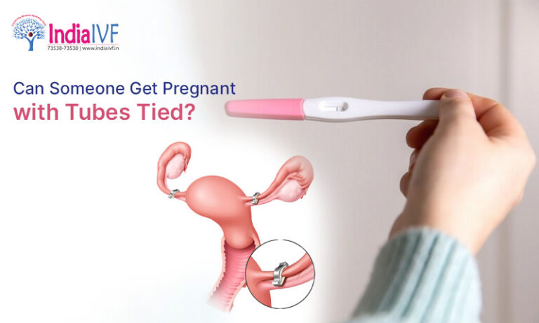 Can Someone Get Pregnant with Tubes Tied