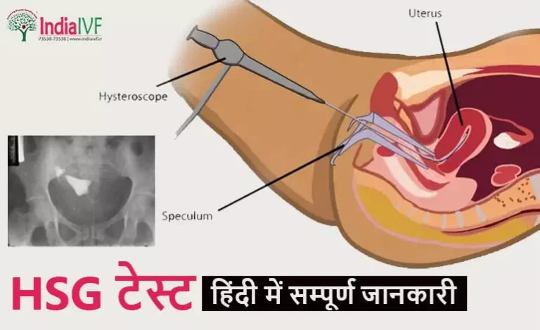 HSG-टेस्ट