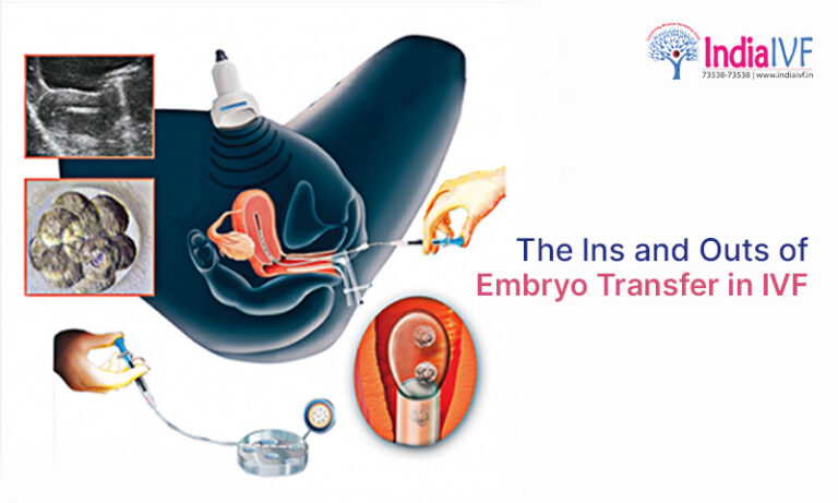 The Ins and Outs of Embryo Transfer in IVF_ A Comprehensive Guide