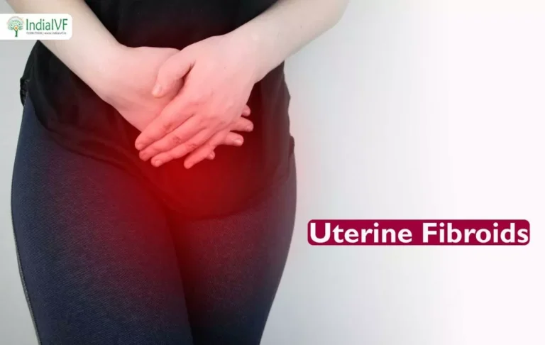 Uterine Fibroids