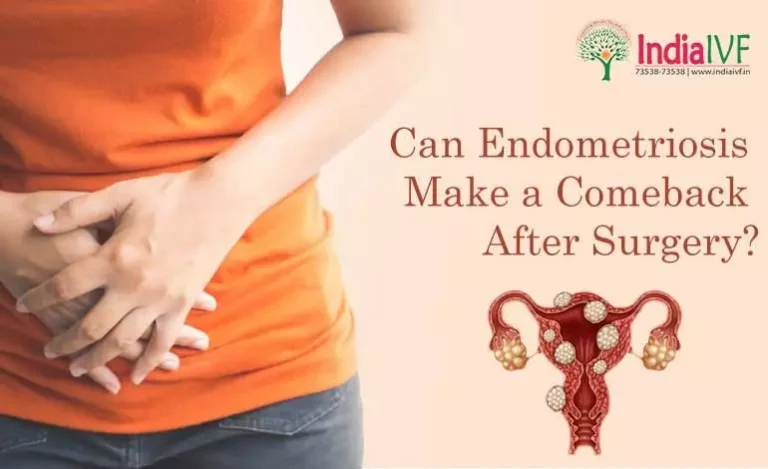 Endometriosis