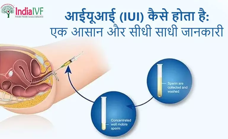 आईयूआई (IUI) कैसे होता है: एक आसान और सीधी साधी जानकारी