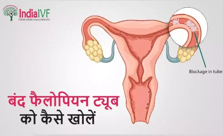 बंद-फैलोपियन-ट्यूब-को-कैसे-खोलें
