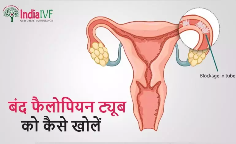बंद-फैलोपियन-ट्यूब-को-कैसे-खोलें