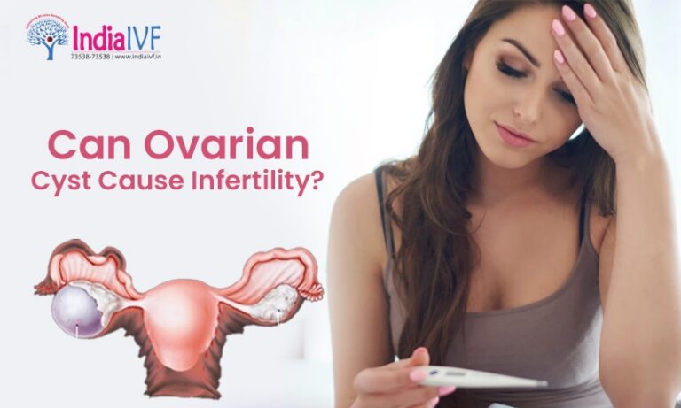 Can Ovarian Cyst Cause Infertility