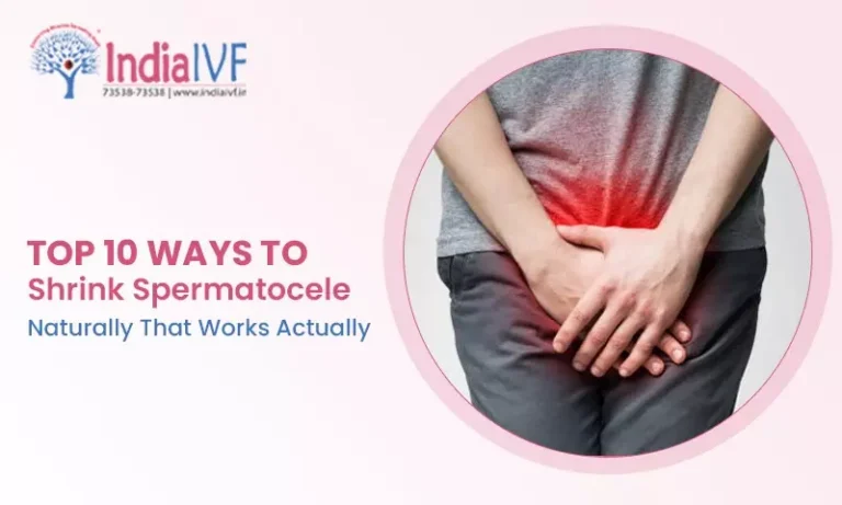 Top 10 Ways to Shrink Spermatocele Naturally