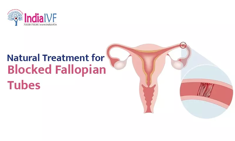 Blocked Fallopian Tubes