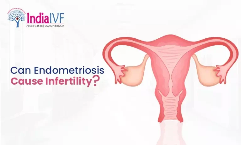 Can Endometriosis Cause Infertility
