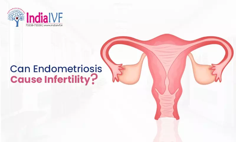 Can Endometriosis Cause Infertility