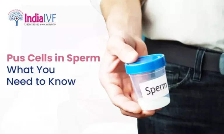 Pus Cells in Sperm