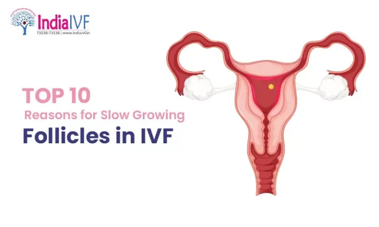 Top 10 Reasons for Slow Growing Follicles in IVF