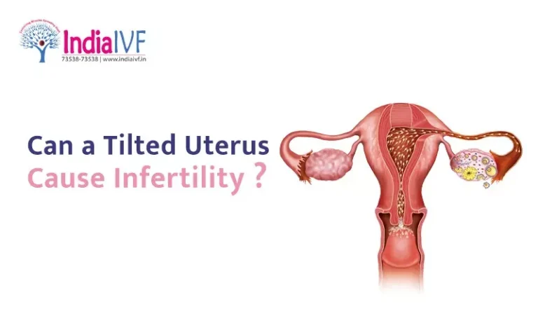 Uterus Cause Infertility