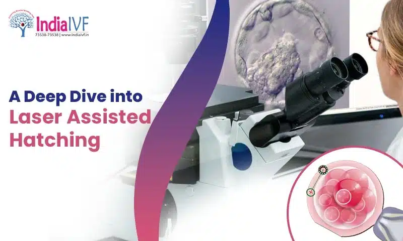 Laser Assisted Hatching