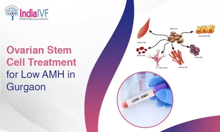 Ovarian Stem Cell Treatment