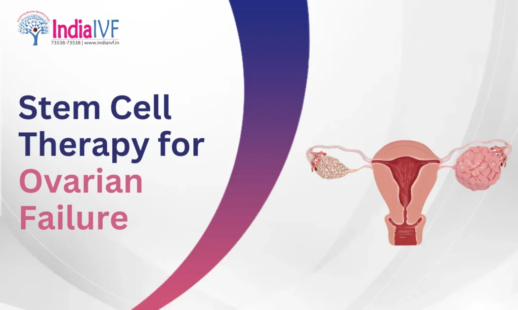 Stem Cell Therapy for Ovarian Failure
