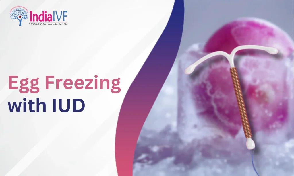 Egg Freezing with IUD