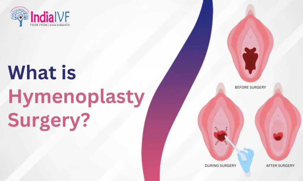Hymenoplasty Surgery