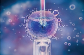 Blastocyst Transfer
