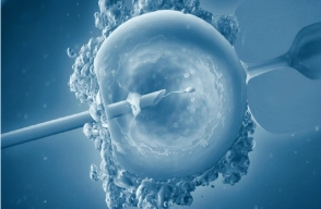 Laser Assisted Hatching