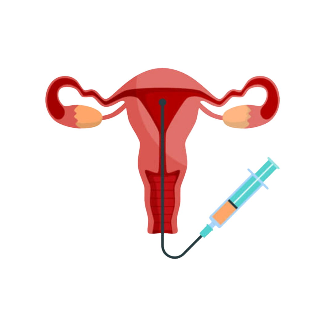 IUI Treatment in Gwalior