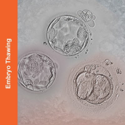 Embryo-Thawing