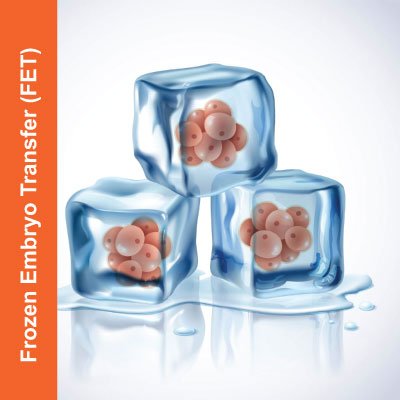 Frozen-Embryo-Transfer-(FET)