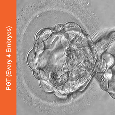 PGT-Every-4-Embryos