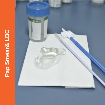 Pap-Smear-LBC