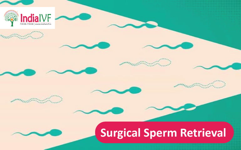 Surgical Sperm-Retrieval