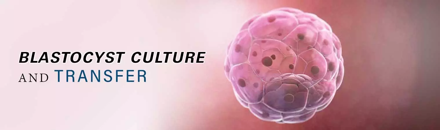 Blastocyst Culture and Transfer