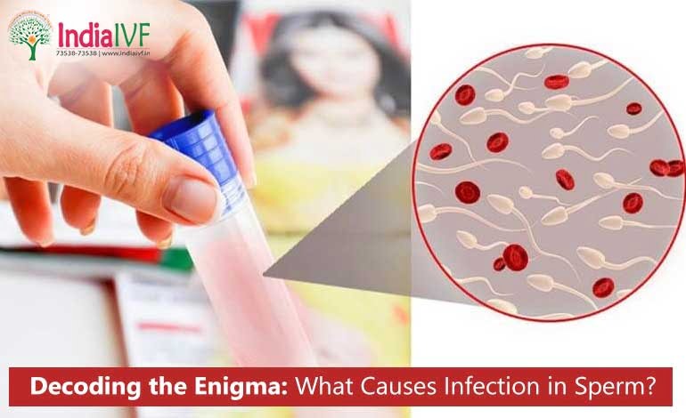 Decoding the Enigma: What Causes Infection in Sperm? The Comprehensive Guide to Male Fertility