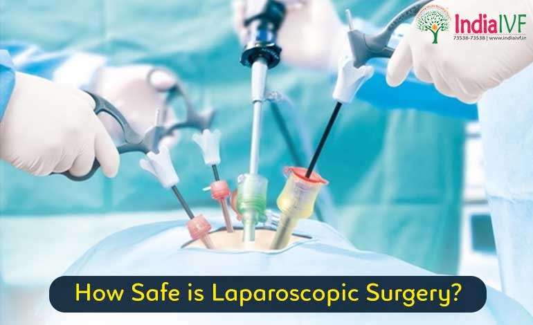 A Peek Inside the World of Laparoscopic Surgery: Unveiling the Safety Aspects