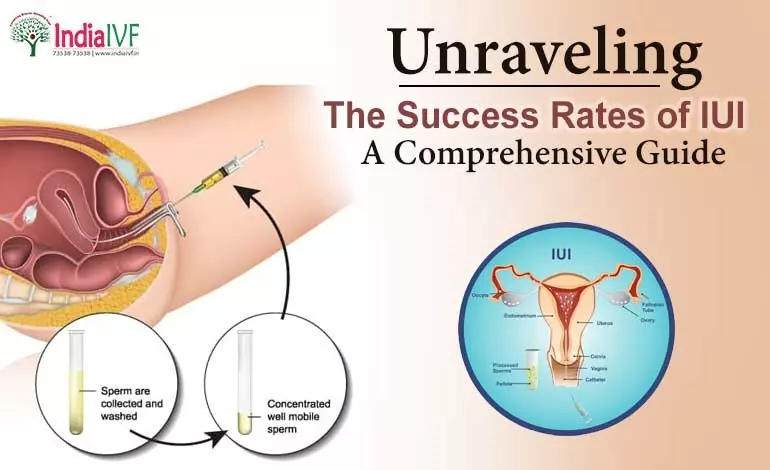 The Full Picture: Unraveling the Success Rates of IUI – A Comprehensive Guide