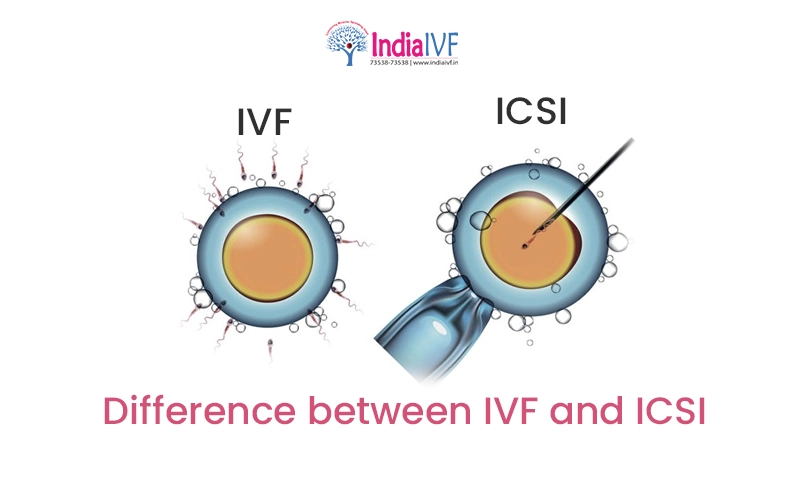 Difference between IVF and ICSI The Ultimate Guide to Making Choices in Fertility Treatment