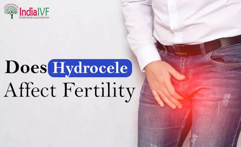 Does Hydrocele Affect Fertility? A Comprehensive Guide