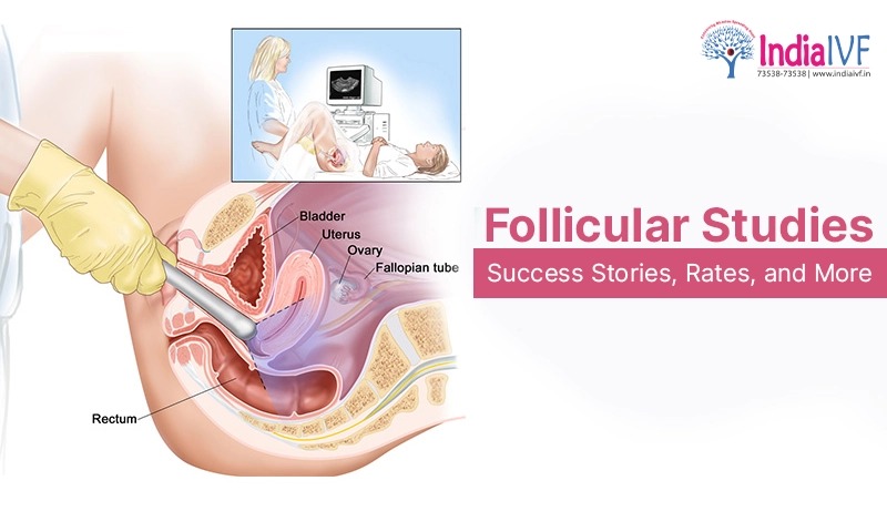 Follicular Studies: Success Stories, Rates, and More