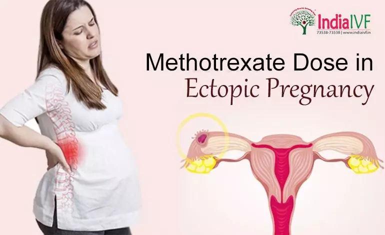 Methotrexate Dose in Ectopic Pregnancy: India IVF Fertility’s Complete Guide