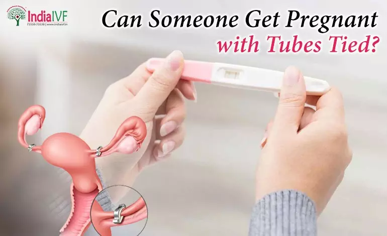 Get Pregnant with Tubes Tied