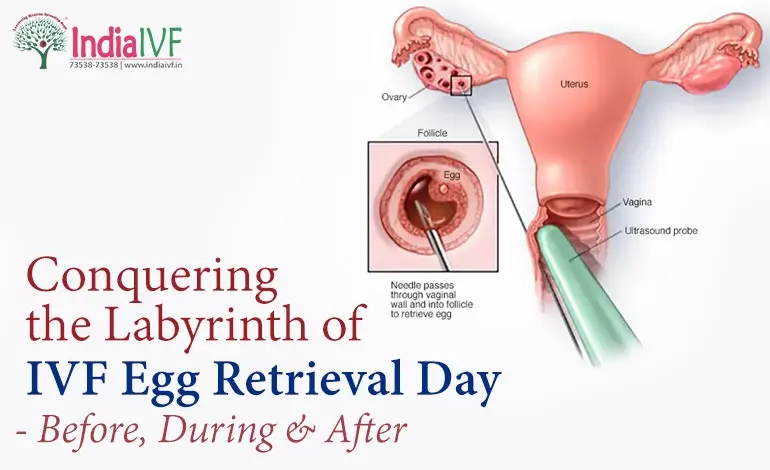 IVF Egg Retrieval Day