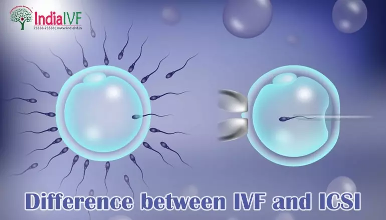 Difference between IVF and ICSI: The Ultimate Guide to Making Choices in Fertility Treatment